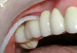 NIĆ DENTYSTYCZNA ORAL-B SUPERFLOSS super floss FV Cechy dodatkowe ortodontyczne