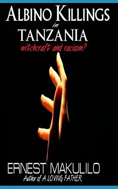 ALBINO KILLINGS IN TANZANIA ERNEST B. MAKULILO